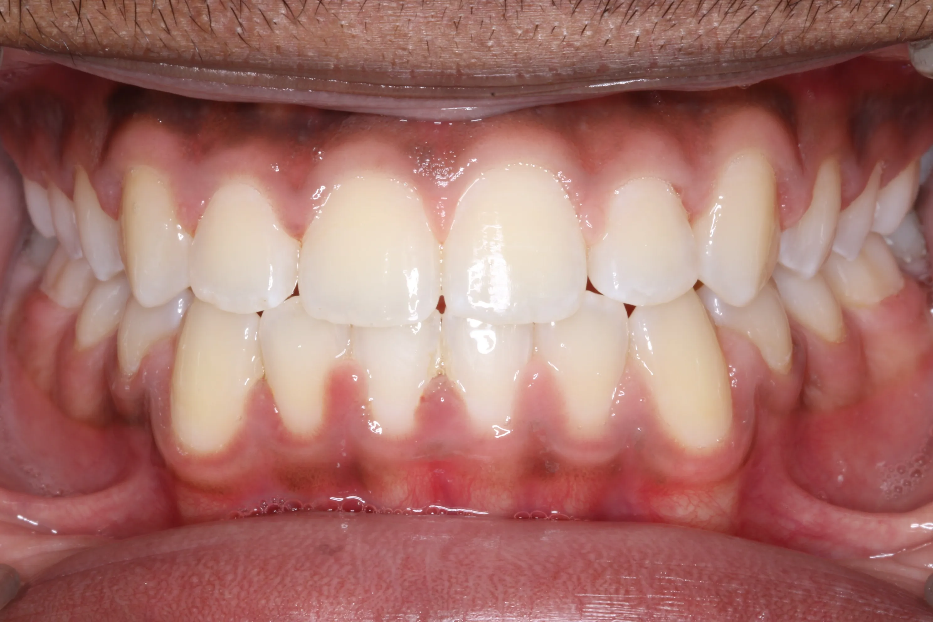 smile-gallery gallery